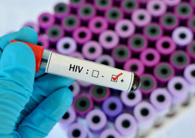 HIV